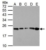 抗 GPX1 兔抗 affinity isolated antibody, buffered aqueous solution