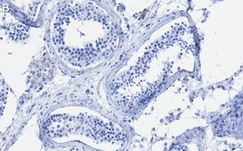 Anti-METTL14 Antibody, clone 2G22 ZooMAb® Rabbit Monoclonal recombinant, expressed in HEK 293 cells