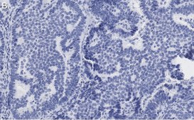 Anti-Beclin 1 Antibody, clone 1E22 , ZooMAb® Rabbit Monoclonal recombinant, expressed in HEK 293 cells