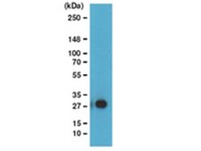 ChIPAb+ 泛素化组蛋白H2B - ChIP验证的抗体和引物组 clone 56, from mouse, purified by using protein G