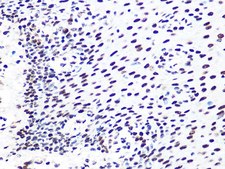 Anti-DDB1 antibody produced in rabbit