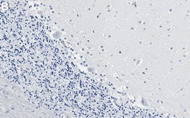 Anti-Myosin-10 Antibody, clone 1B3 ZooMAb® Rabbit Monoclonal recombinant, expressed in HEK 293 cells
