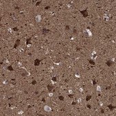 Anti-Ppfibp1 Antibody Produced In Rabbit Prestige Antibodies® Powered by Atlas Antibodies, affinity isolated antibody, buffered aqueous glycerol solution