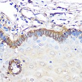 Anti-Ferritin Light Chain antibody produced in rabbit