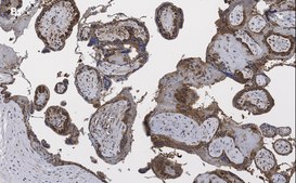 抗-BCRP (ABCG2)抗体，克隆10K5，ZooMAb®兔单克隆抗体 recombinant, expressed in HEK 293 cells