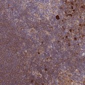 Anti-CDC25B antibody produced in rabbit Prestige Antibodies® Powered by Atlas Antibodies, affinity isolated antibody, buffered aqueous glycerol solution