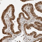 Anti-ADPRHL2 antibody produced in rabbit Prestige Antibodies® Powered by Atlas Antibodies, affinity isolated antibody, buffered aqueous glycerol solution