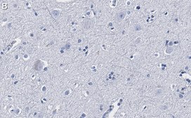 Anti-CGRP-1 Antibody, clone 2E18 ZooMAb® Rabbit Monoclonal recombinant, expressed in HEK 293 cells