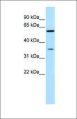Anti-AKR1B1 antibody produced in rabbit affinity isolated antibody