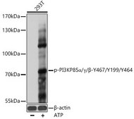 Anti-Phospho-PI3KP85α/γ/β-Y467/Y199/Y464 antibody produced in rabbit