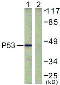 Anti-p53 antibody produced in rabbit affinity isolated antibody