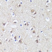 Anti- LC3B antibody produced in rabbit