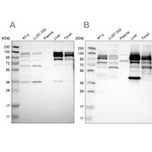 Anti-RRBP1 antibody produced in rabbit Prestige Antibodies® Powered by Atlas Antibodies, affinity isolated antibody, buffered aqueous glycerol solution