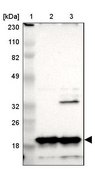 Anti-NDUFB8 antibody produced in rabbit Prestige Antibodies® Powered by Atlas Antibodies, affinity isolated antibody, buffered aqueous glycerol solution