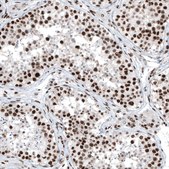 Anti-BRD4 antibody produced in rabbit Prestige Antibodies® Powered by Atlas Antibodies, affinity isolated antibody, buffered aqueous glycerol solution