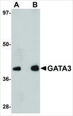 Anti-GATA3 antibody produced in rabbit affinity isolated antibody, buffered aqueous solution