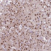 Anti-MGMT antibody produced in rabbit Prestige Antibodies® Powered by Atlas Antibodies, affinity isolated antibody