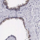 Anti-ARG2 antibody produced in rabbit affinity isolated antibody, buffered aqueous glycerol solution