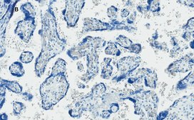 Anti-GLUT-1 Antibody, CT, clone 16D21, ZooMAb® Rabbit Monoclonal recombinant, expressed in HEK 293 cells