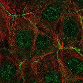 Anti-PAK4 antibody produced in rabbit Prestige Antibodies® Powered by Atlas Antibodies, affinity isolated antibody