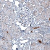 Monoclonal Anti-AFP antibody produced in mouse Prestige Antibodies® Powered by Atlas Antibodies, clone CL9772, purified immunoglobulin, buffered aqueous glycerol solution
