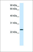 Anti-ARF1 antibody produced in rabbit affinity isolated antibody