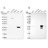 Anti-ADH6 Prestige Antibodies® Powered by Atlas Antibodies, affinity isolated antibody