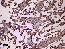 Anti-CD32/FCGR2B antibody produced in goat affinity isolated antibody, buffered aqueous solution