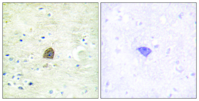 Anti-phospho-CaMK2α/β/δ (pThr305) antibody produced in rabbit affinity isolated antibody