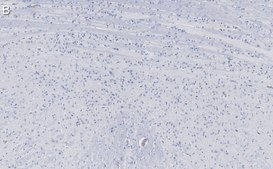 Anti-Calretinin Antibody, clone 6B8.2 ZooMAb® Mouse Monoclonal recombinant, expressed in HEK 293 cells