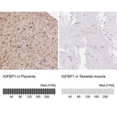 Anti-IGFBP1 antibody produced in rabbit Prestige Antibodies® Powered by Atlas Antibodies, affinity isolated antibody, buffered aqueous glycerol solution