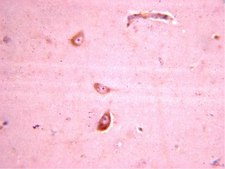 Anti-Glutamate Receptor 4 Antibody Chemicon®, from rabbit