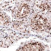 Monoclonal Anti-METTL14 antibody produced in mouse Prestige Antibodies® Powered by Atlas Antibodies, clone CL4252, purified immunoglobulin