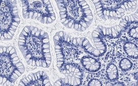 Anti-Nucleolin Antibody, clone 5D13 ZooMAb® Rabbit Monoclonal recombinant, expressed in HEK 293 cells