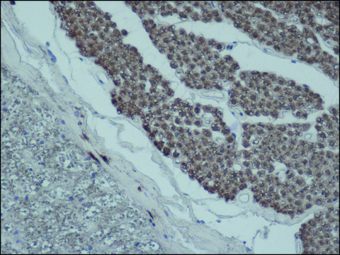 Anti-PMP22 antibody produced in rabbit ~1.0 mg/mL, affinity isolated antibody, buffered aqueous solution