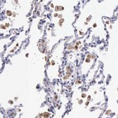 Anti-TYMP antibody produced in rabbit Prestige Antibodies® Powered by Atlas Antibodies, affinity isolated antibody, buffered aqueous glycerol solution