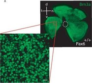 Anti-Brn-3a Antibody, POU-domain protein, clone 5A3.2 culture supernatant, clone 5A3.2, Chemicon®