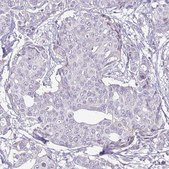 Monoclonal Anti-HER2 antibody produced in mouse Prestige Antibodies® Powered by Atlas Antibodies, clone CL0268, purified immunoglobulin, buffered aqueous glycerol solution