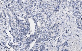 Anti-53BP1 Antibody, clone BP13 ZooMAb® Mouse Monoclonal recombinant, expressed in HEK 293 cells