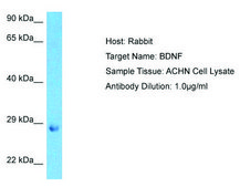 Anti-BDNF antibody produced in rabbit