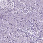 Anti-GABRB2 antibody produced in rabbit Prestige Antibodies® Powered by Atlas Antibodies, affinity isolated antibody, buffered aqueous glycerol solution