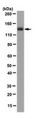 Anti-JMJD2A Antibody, clone 8B7.1, rabbit monoclonal clone 8B7.1, from rabbit