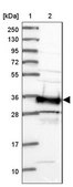 Anti-SMN1 antibody produced in rabbit Prestige Antibodies® Powered by Atlas Antibodies, affinity isolated antibody, buffered aqueous glycerol solution