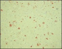 抗β-淀粉样抗体，小鼠单克隆 小鼠抗 clone BAM-10, purified from hybridoma cell culture