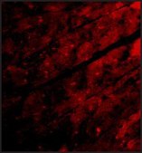 Anti-TRPC3 (ab3) antibody produced in rabbit affinity isolated antibody, buffered aqueous solution