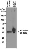 Anti-BMI1 Antibody, clone AF27 clone AF27, from mouse