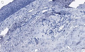 抗-胶原X α1 抗体，克隆1O4 ZooMAb® 兔单克隆 recombinant, expressed in HEK 293 cells