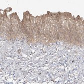 Anti-TBCC antibody produced in rabbit Prestige Antibodies® Powered by Atlas Antibodies, affinity isolated antibody, buffered aqueous glycerol solution