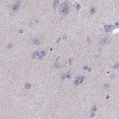 Anti-CALCR antibody produced in rabbit Prestige Antibodies® Powered by Atlas Antibodies, affinity isolated antibody