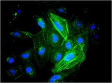 LX-2 Human Hepatic Stellate Cell Line a highly suitable model of human hepatic fibrosis